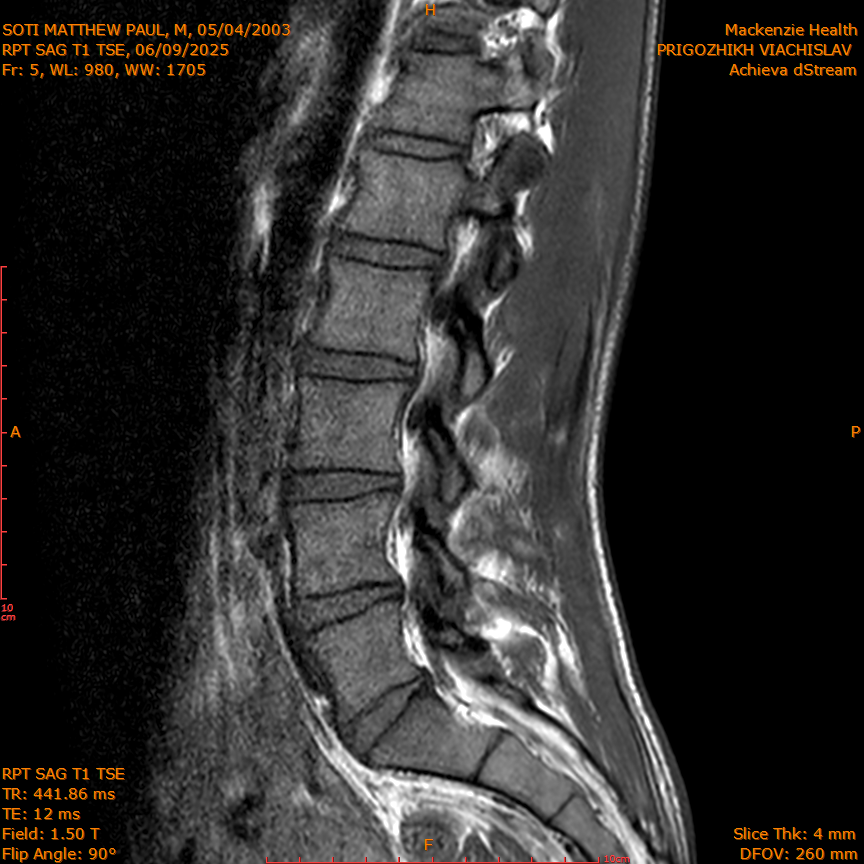 2025-06-09/RPT SAG T1 TSE/0006-IM213.png