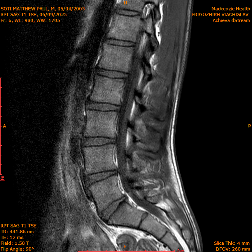 2025-06-09/RPT SAG T1 TSE/0007-IM214.png