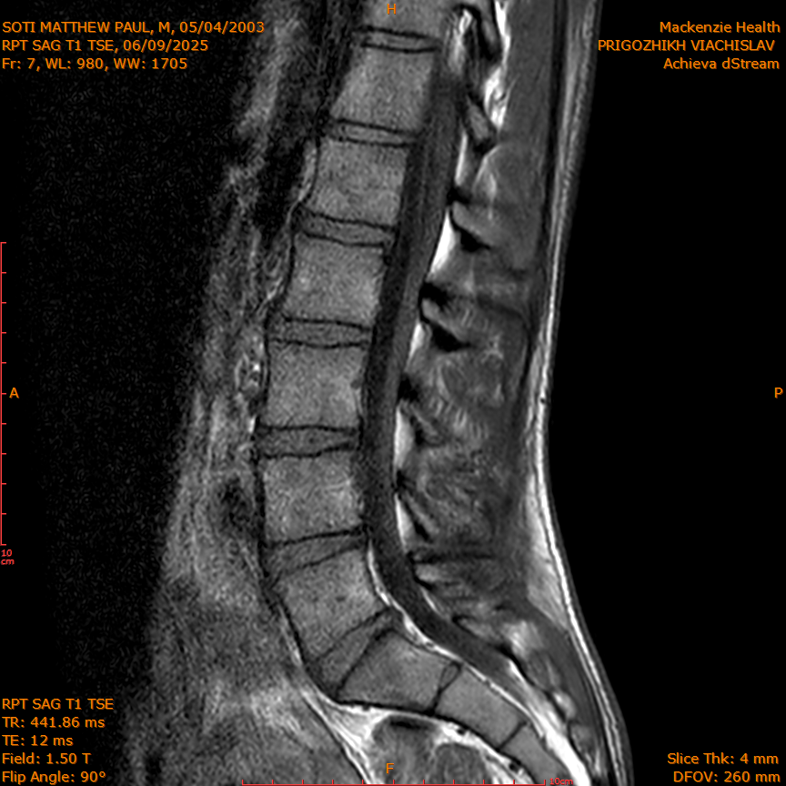 2025-06-09/RPT SAG T1 TSE/0008-IM215.png