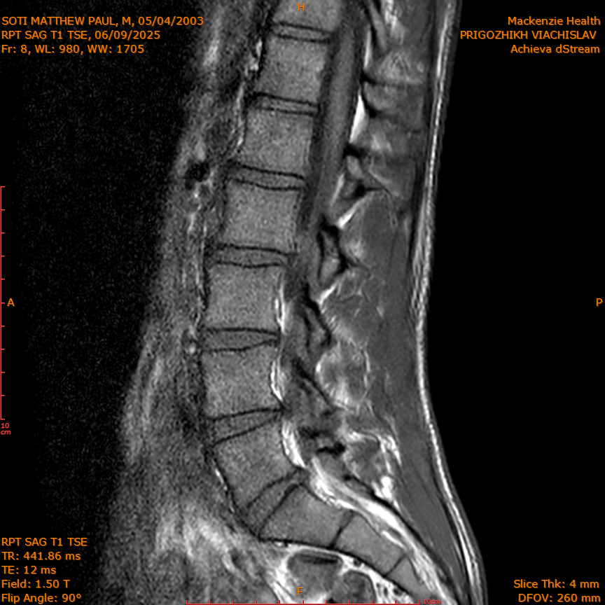 2025-06-09/RPT SAG T1 TSE/0009-IM216.png