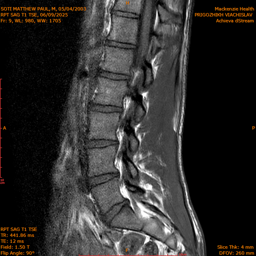 2025-06-09/RPT SAG T1 TSE/0010-IM217.png