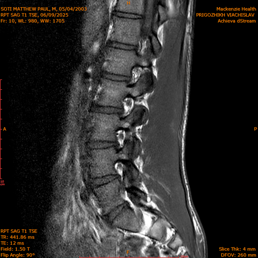 2025-06-09/RPT SAG T1 TSE/0011-IM218.png