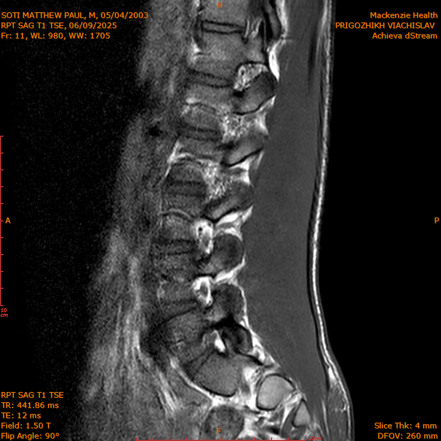2025-06-09/RPT SAG T1 TSE/0012-IM219.png