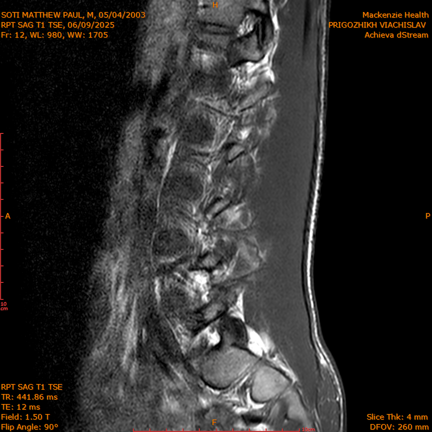 2025-06-09/RPT SAG T1 TSE/0013-IM220.png