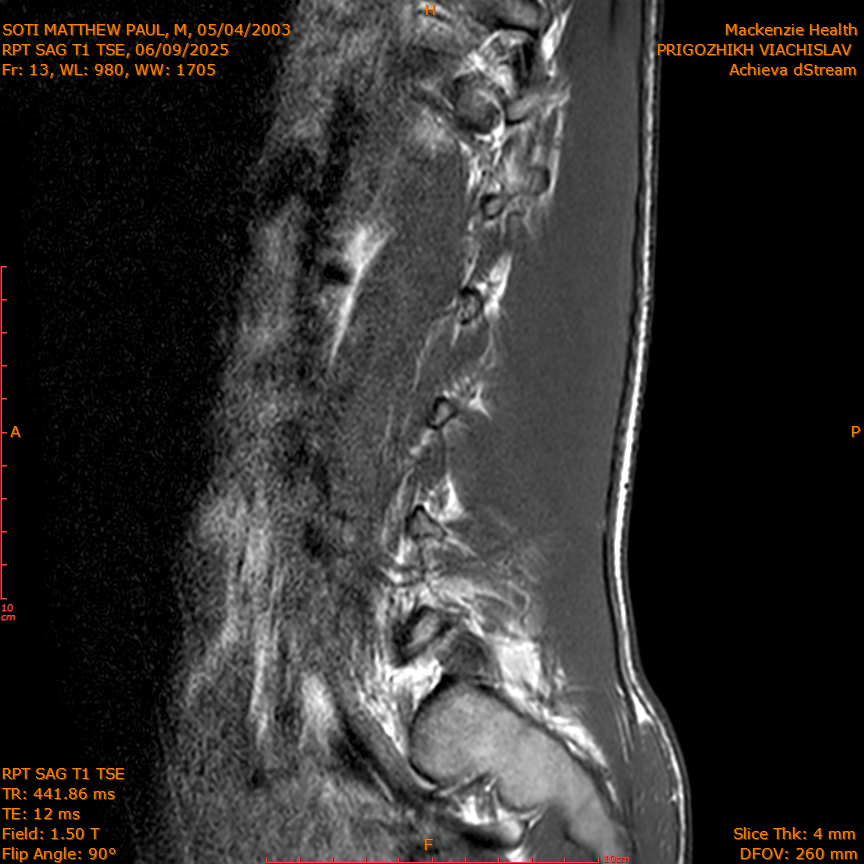 2025-06-09/RPT SAG T1 TSE/0014-IM221.png
