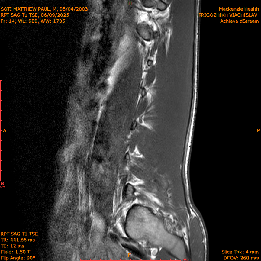 2025-06-09/RPT SAG T1 TSE/0015-IM222.png