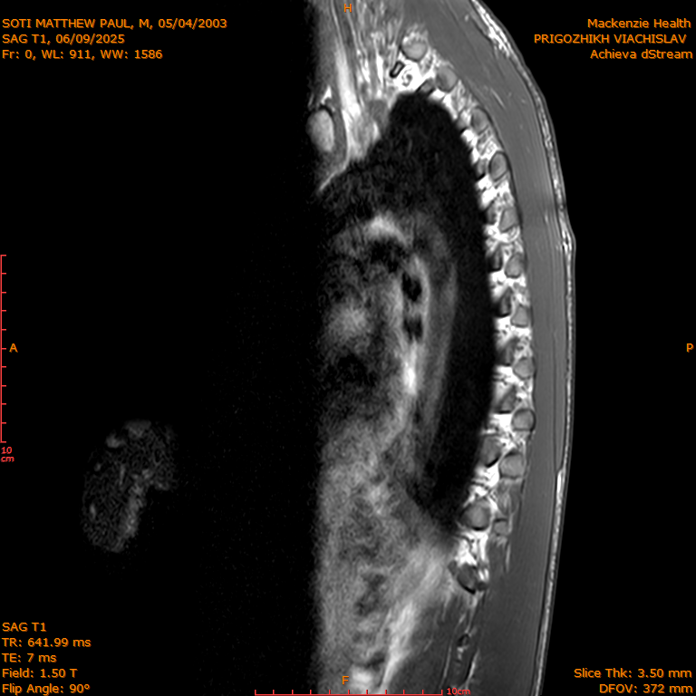 2025-06-09/SAG T1/0001-IM270.png
