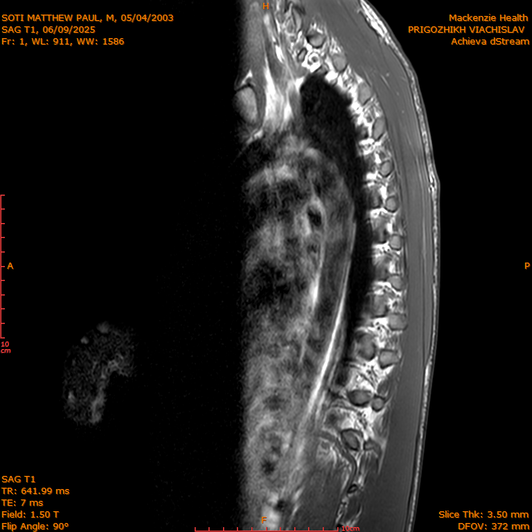 2025-06-09/SAG T1/0002-IM271.png