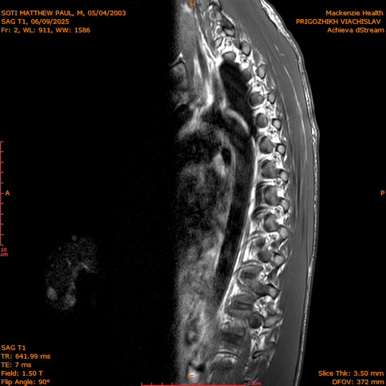 2025-06-09/SAG T1/0003-IM272.png