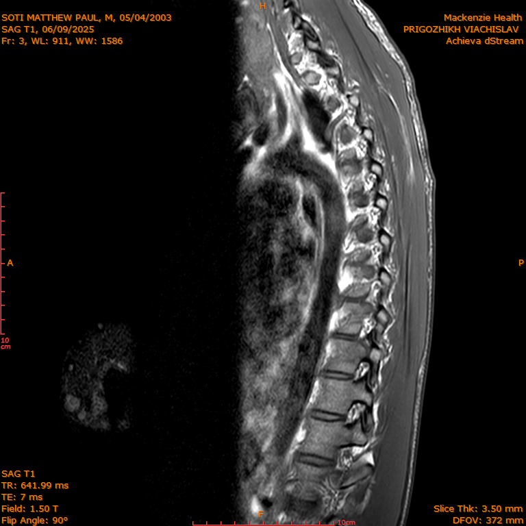 2025-06-09/SAG T1/0004-IM273.png