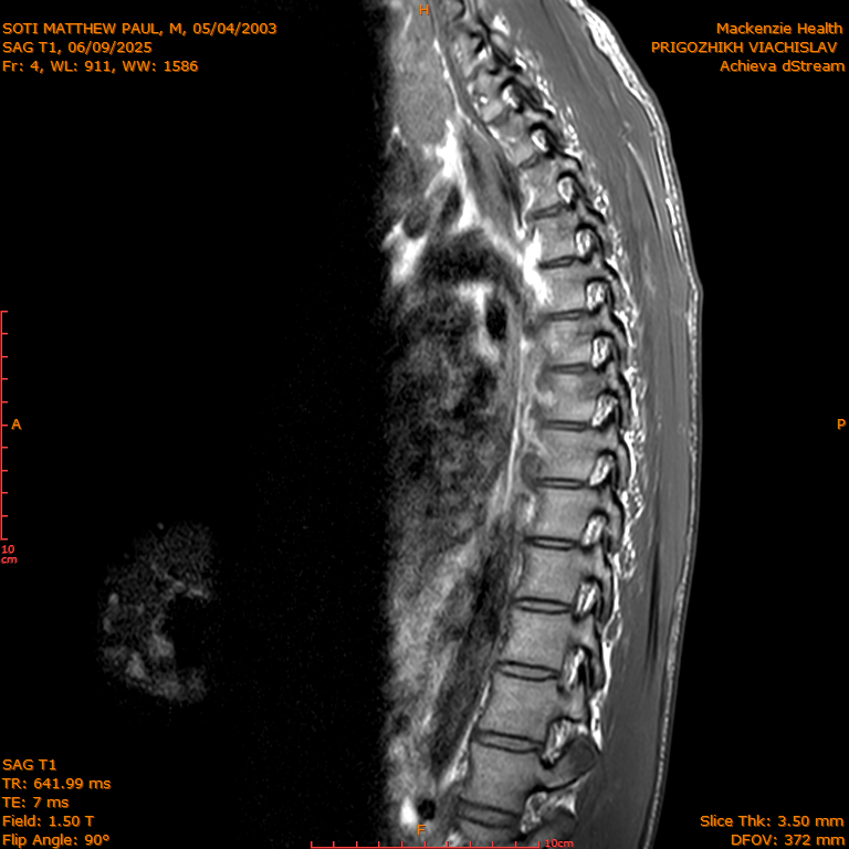 2025-06-09/SAG T1/0005-IM274.png