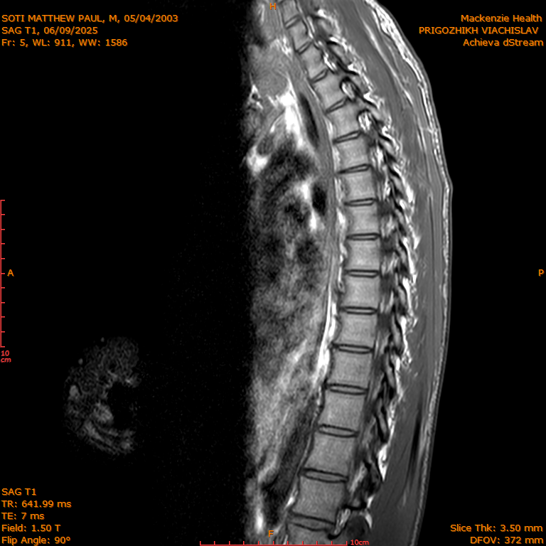 2025-06-09/SAG T1/0006-IM275.png