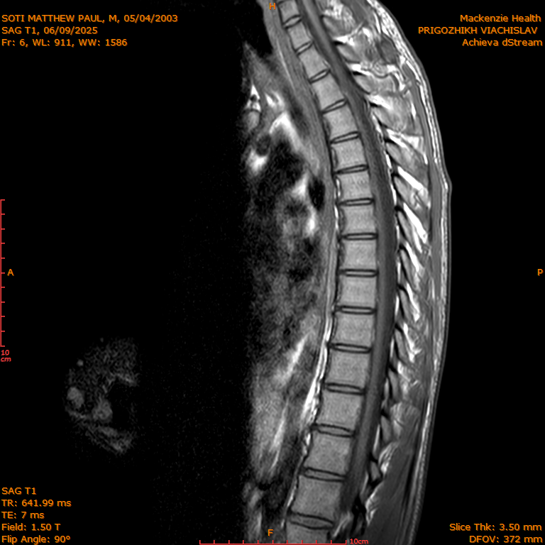 2025-06-09/SAG T1/0007-IM276.png