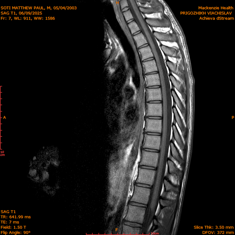 2025-06-09/SAG T1/0008-IM277.png