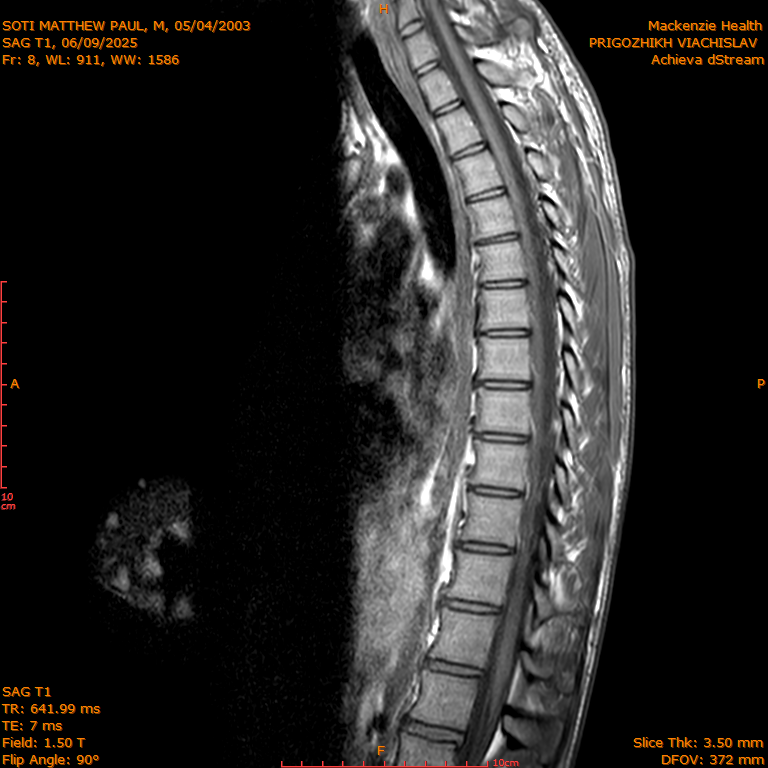 2025-06-09/SAG T1/0009-IM278.png
