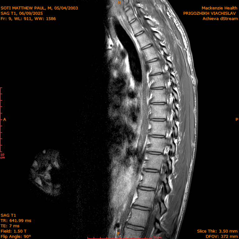 2025-06-09/SAG T1/0010-IM279.png