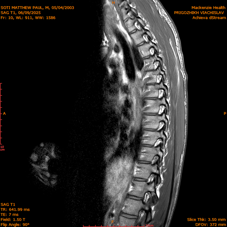 2025-06-09/SAG T1/0011-IM280.png