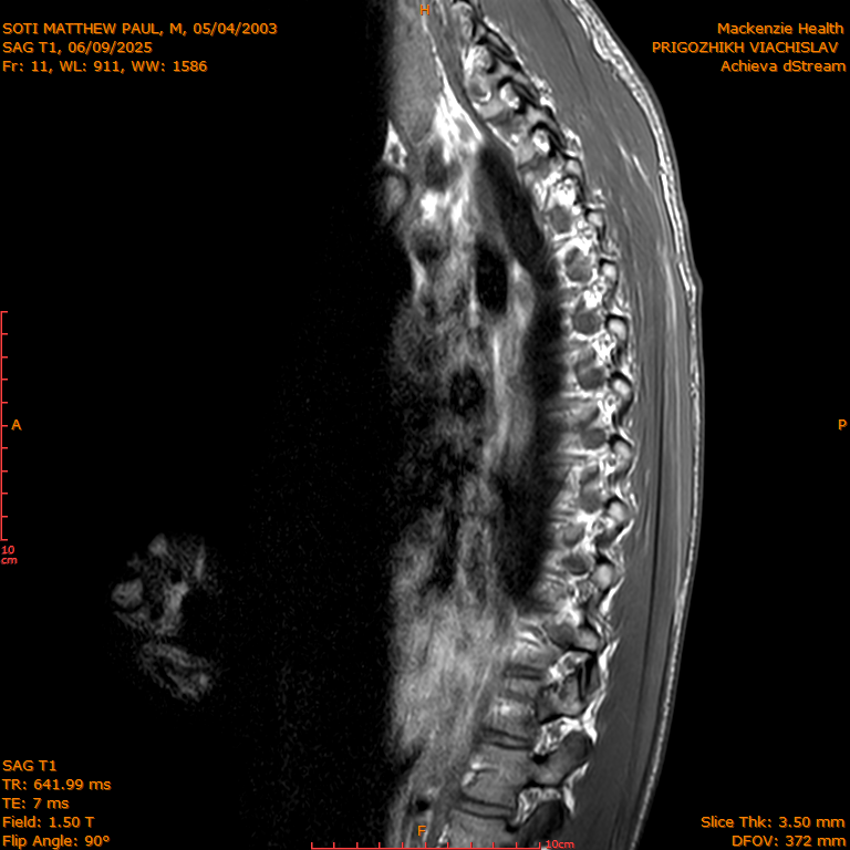 2025-06-09/SAG T1/0012-IM281.png
