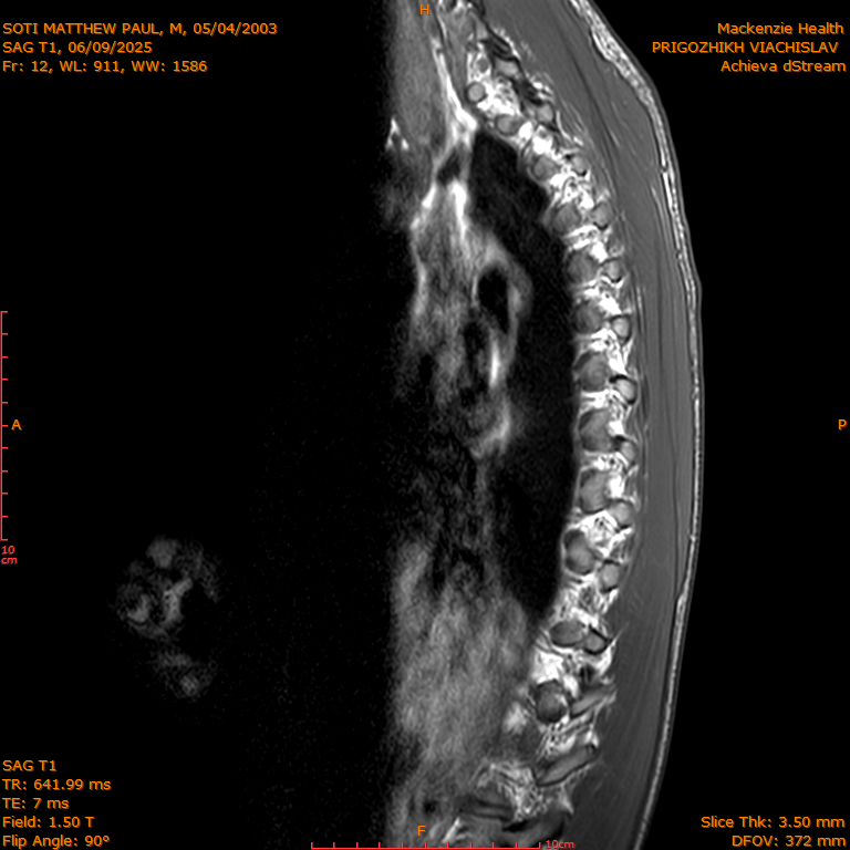 2025-06-09/SAG T1/0013-IM282.png