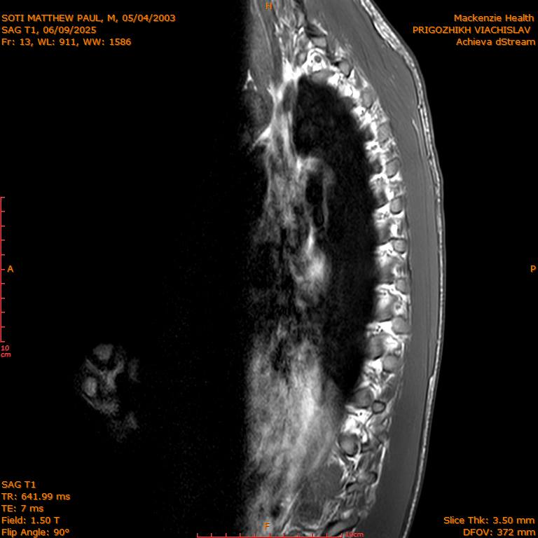 2025-06-09/SAG T1/0014-IM283.png