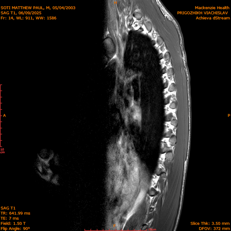 2025-06-09/SAG T1/0015-IM284.png