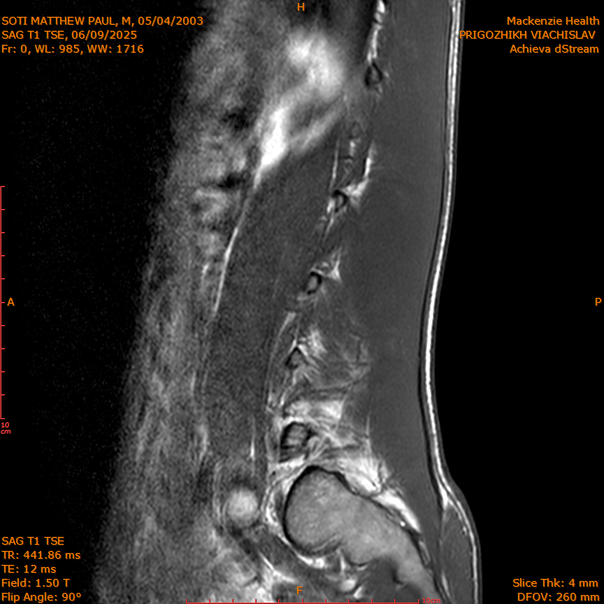 2025-06-09/SAG T1 TSE/0001-IM315.png
