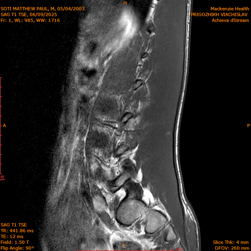 2025-06-09/SAG T1 TSE/0002-IM316.png