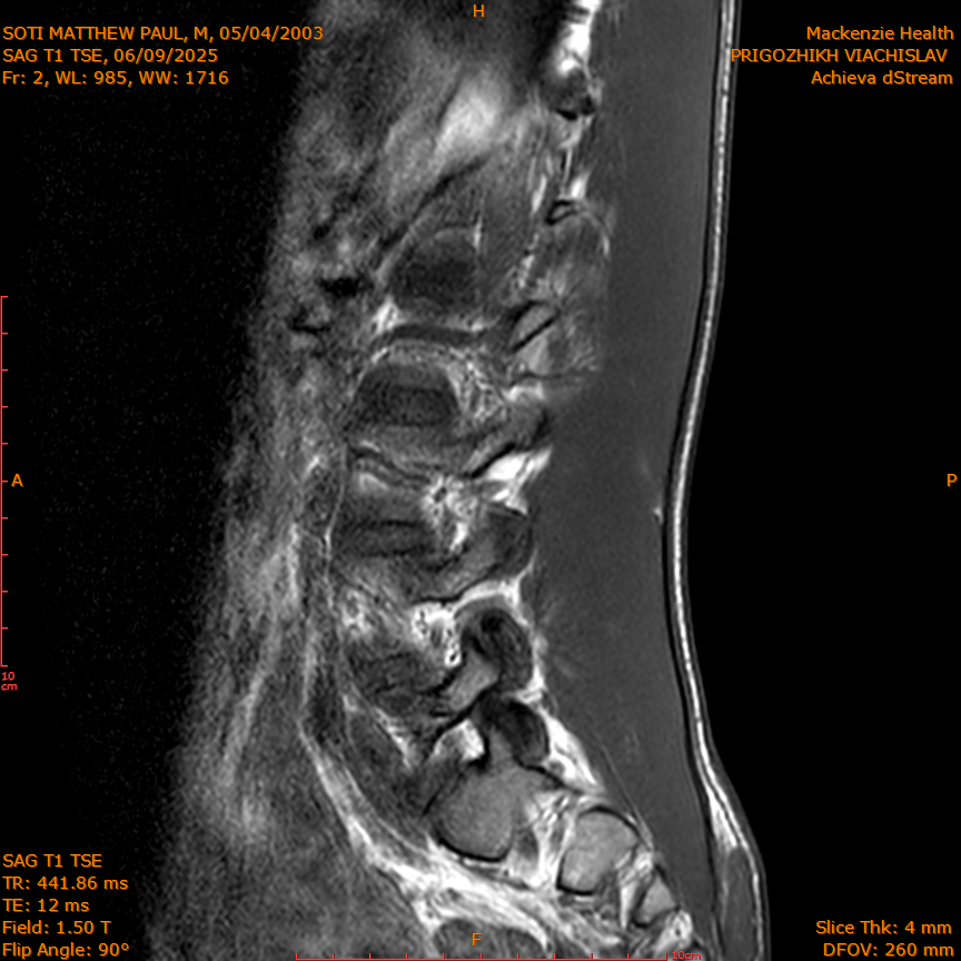 2025-06-09/SAG T1 TSE/0003-IM317.png