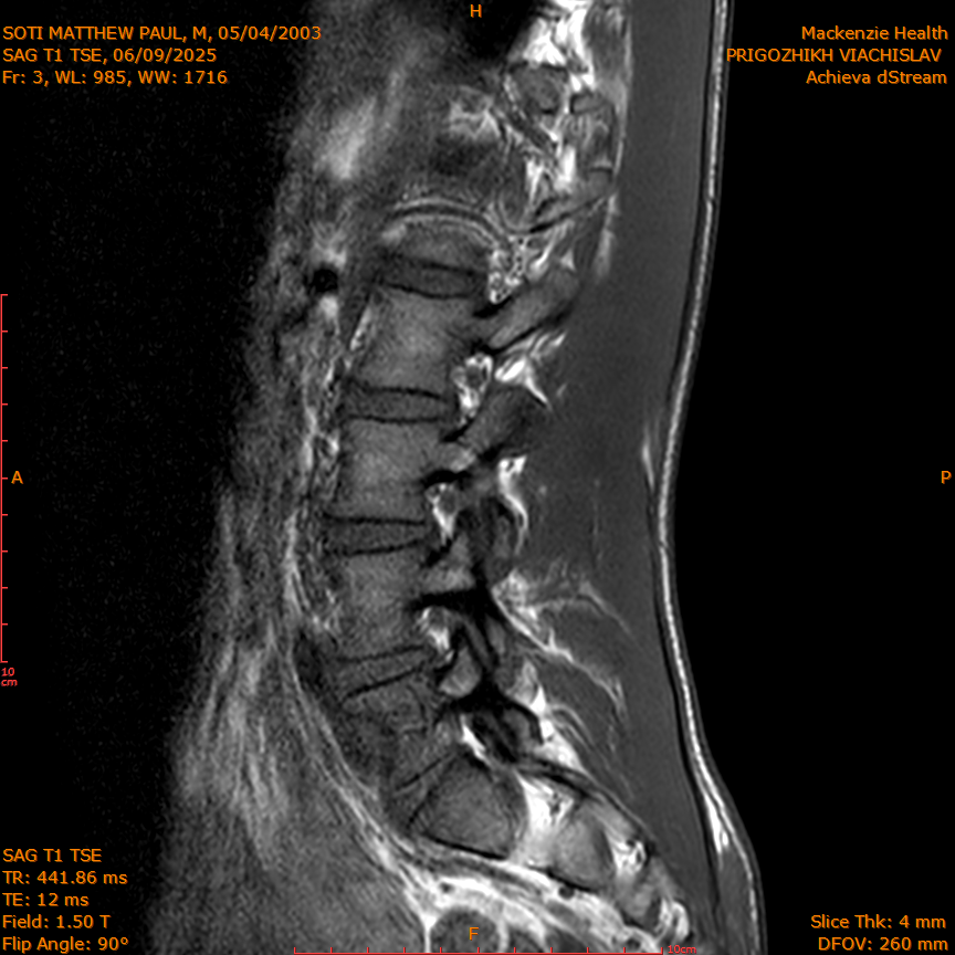 2025-06-09/SAG T1 TSE/0004-IM318.png