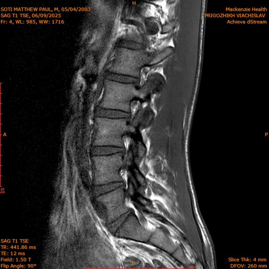 2025-06-09/SAG T1 TSE/0005-IM319.png