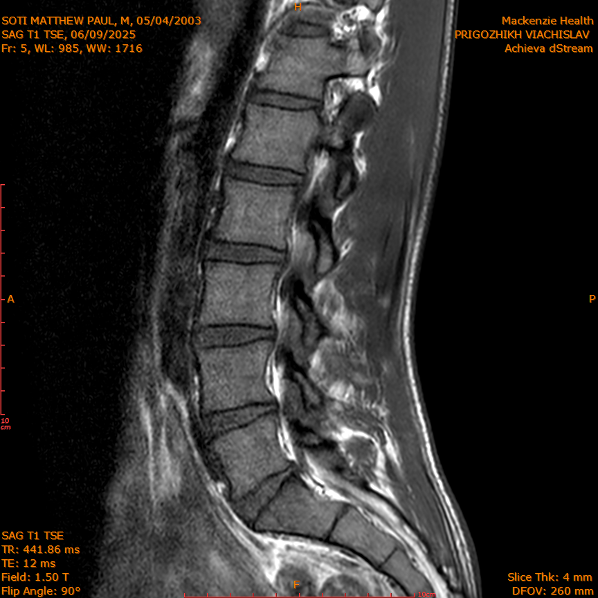 2025-06-09/SAG T1 TSE/0006-IM320.png