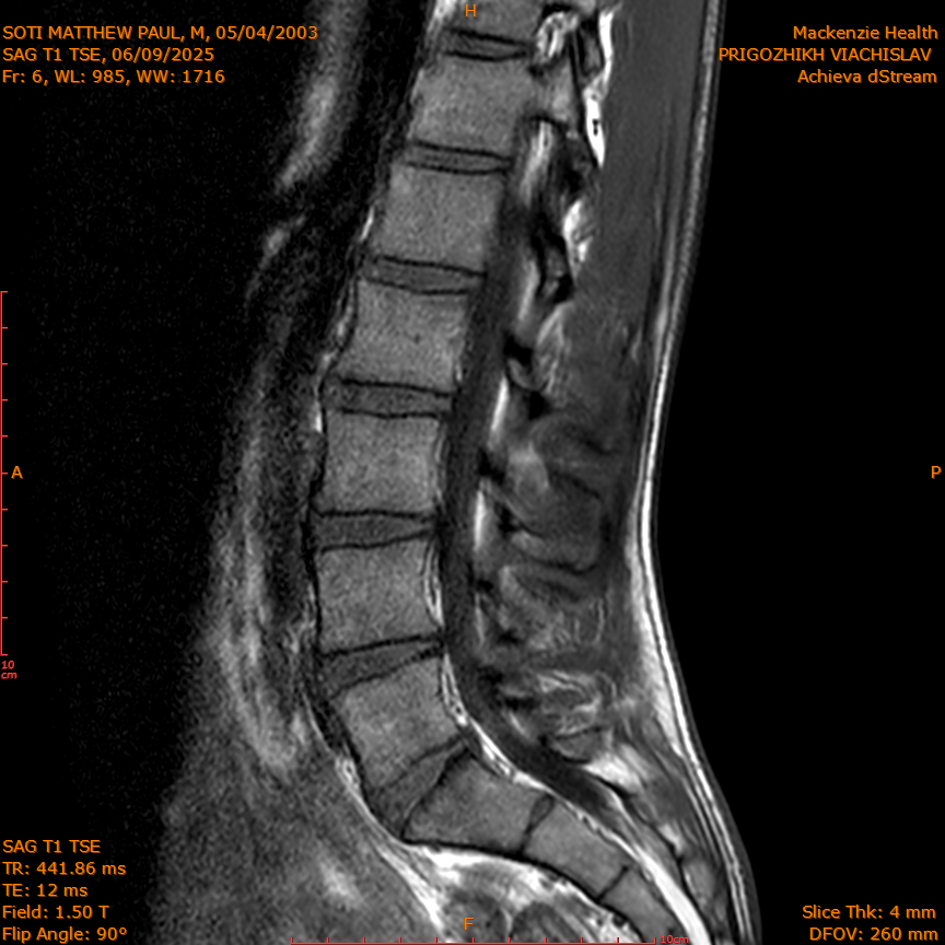 2025-06-09/SAG T1 TSE/0007-IM321.png