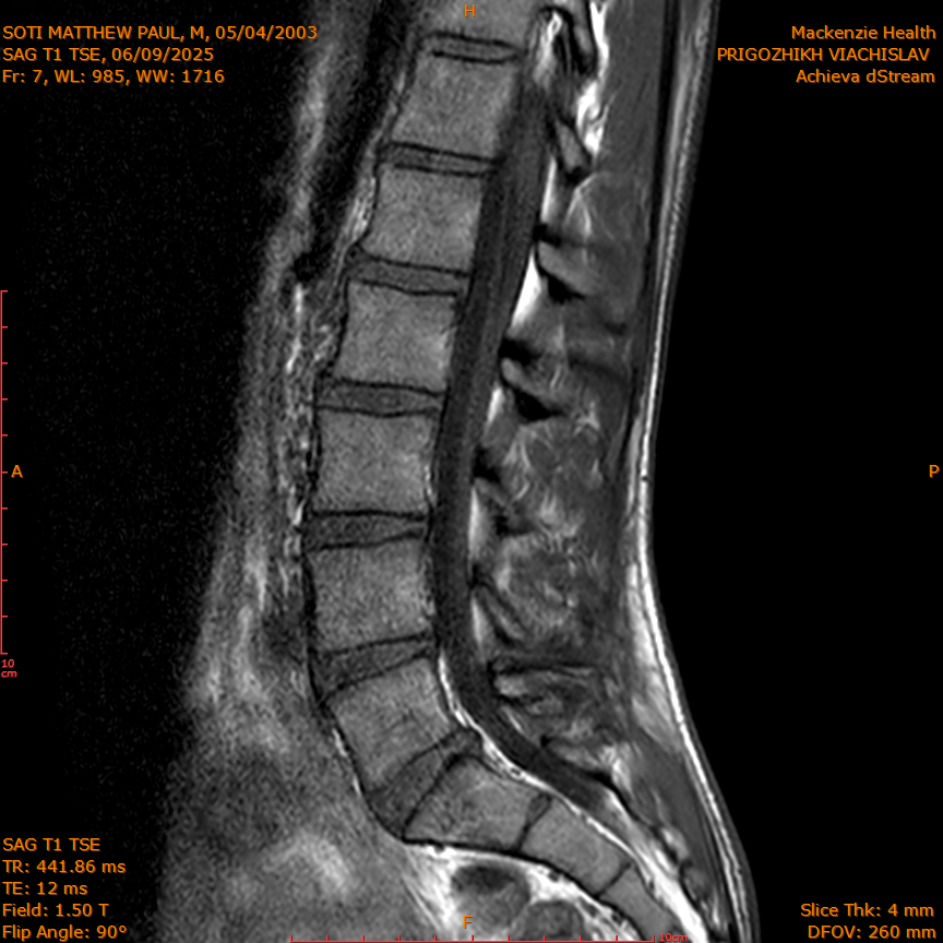 2025-06-09/SAG T1 TSE/0008-IM322.png