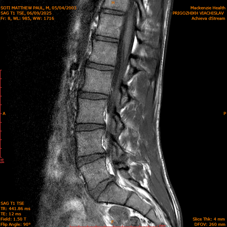 2025-06-09/SAG T1 TSE/0009-IM323.png