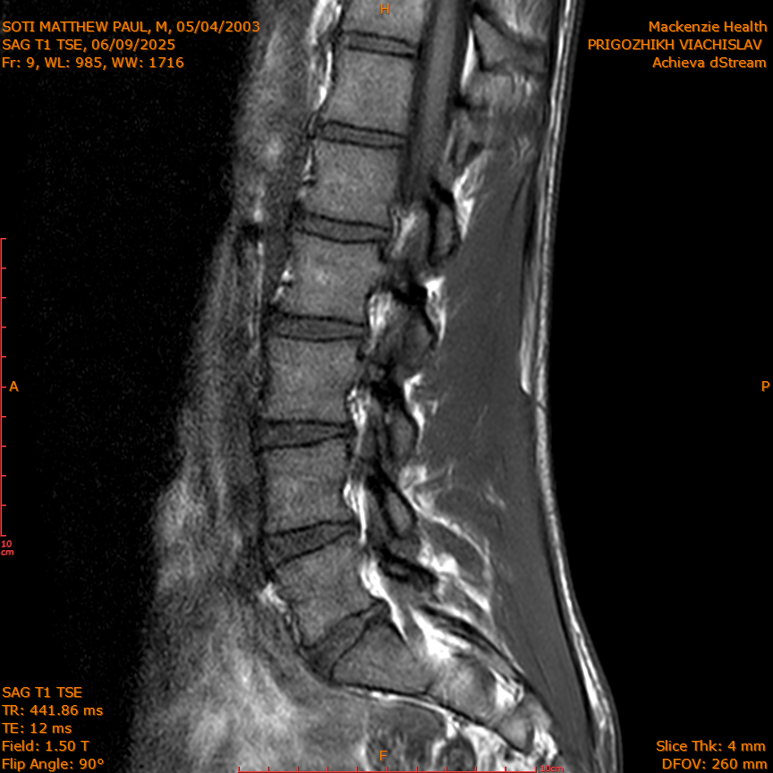 2025-06-09/SAG T1 TSE/0010-IM324.png