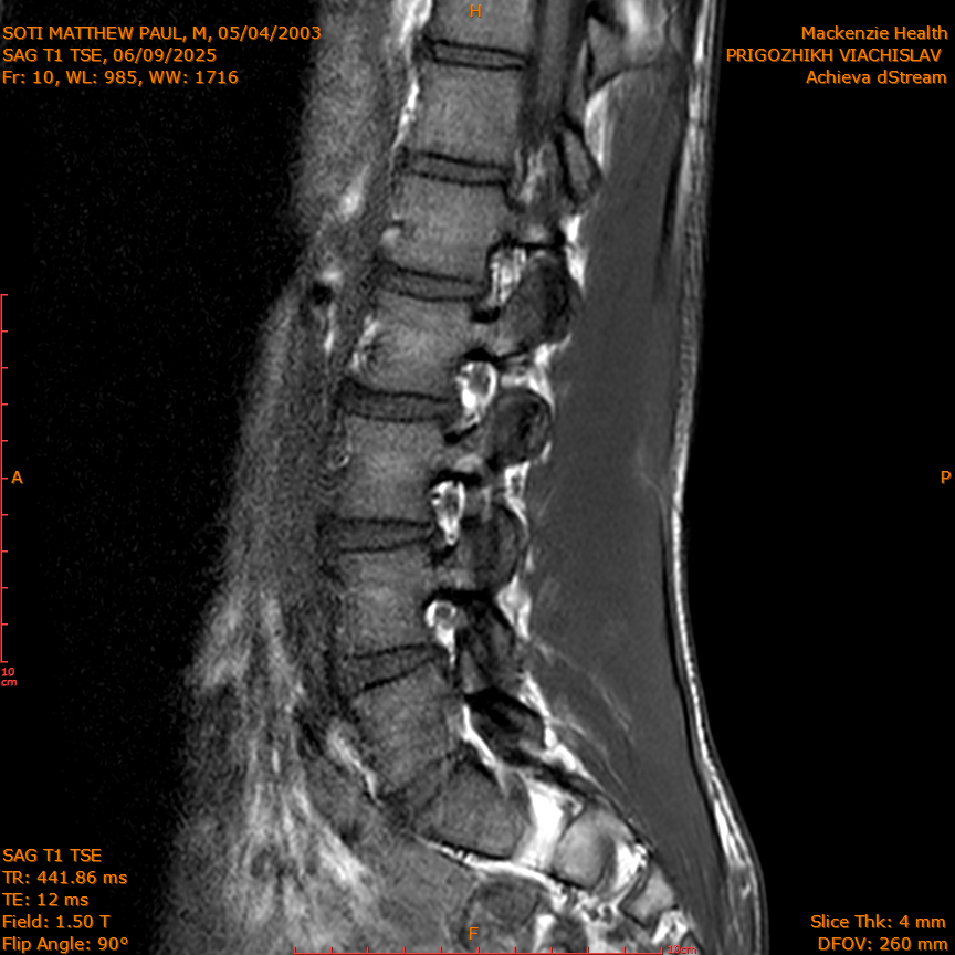 2025-06-09/SAG T1 TSE/0011-IM325.png