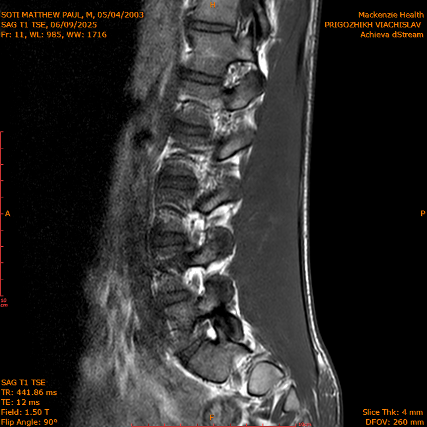 2025-06-09/SAG T1 TSE/0012-IM326.png