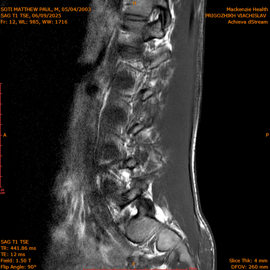 2025-06-09/SAG T1 TSE/0013-IM327.png