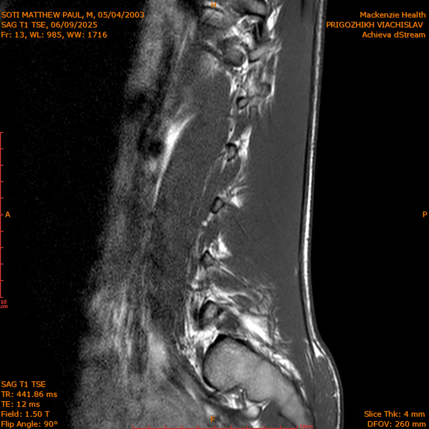 2025-06-09/SAG T1 TSE/0014-IM328.png