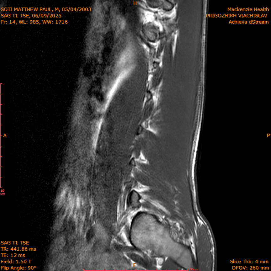 2025-06-09/SAG T1 TSE/0015-IM329.png