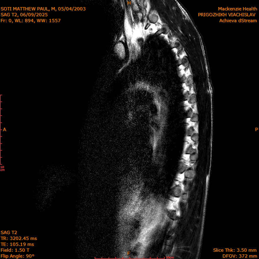 2025-06-09/SAG T2/0001-IM255.png