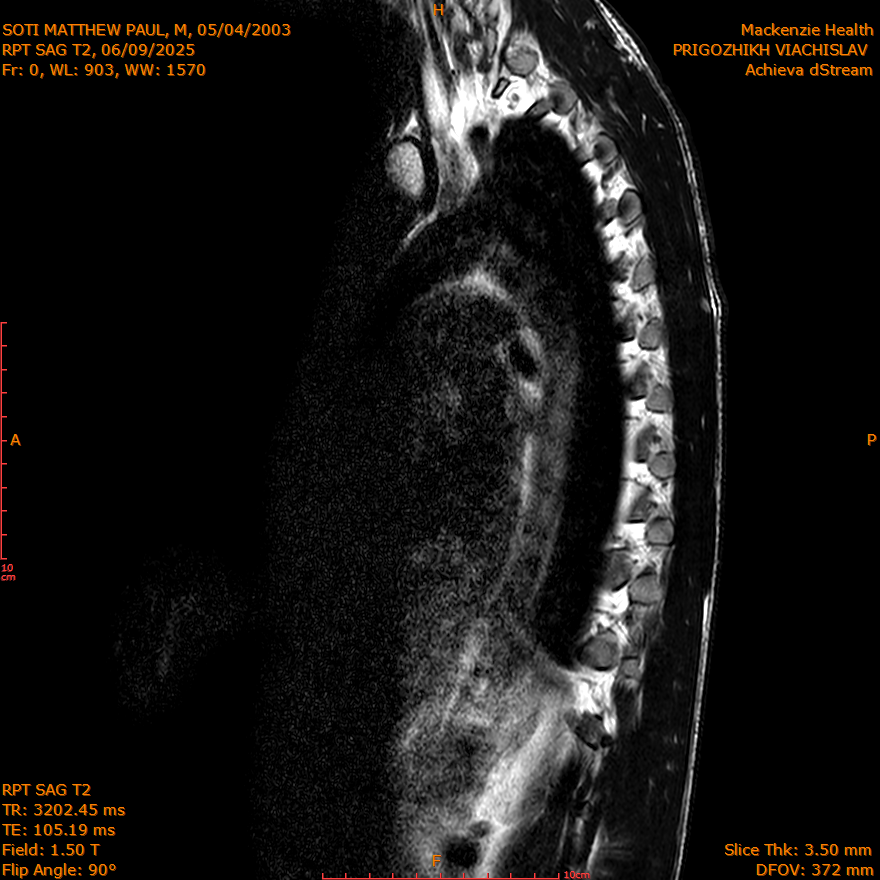 2025-06-09/SAG T2/0001-IM285.png