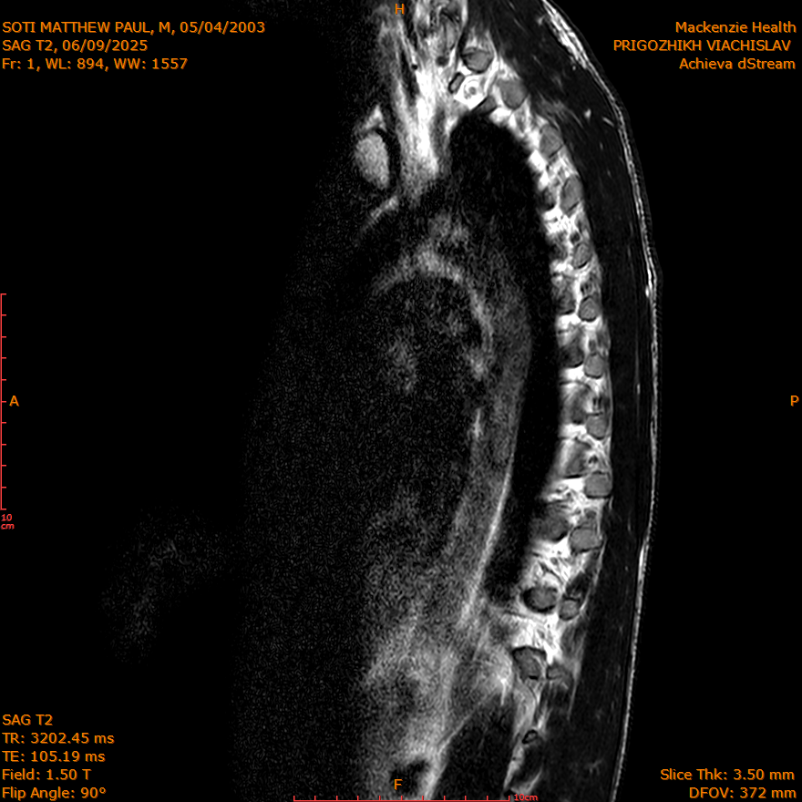 2025-06-09/SAG T2/0002-IM256.png