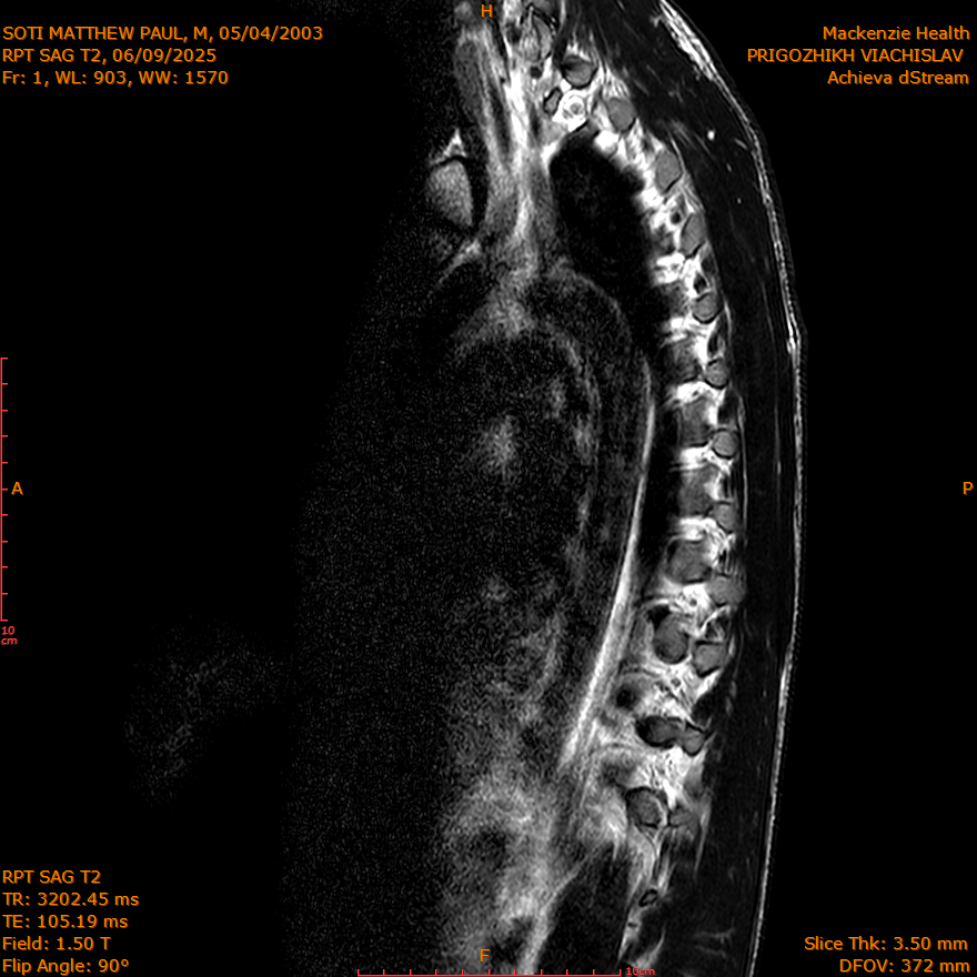 2025-06-09/SAG T2/0002-IM286.png