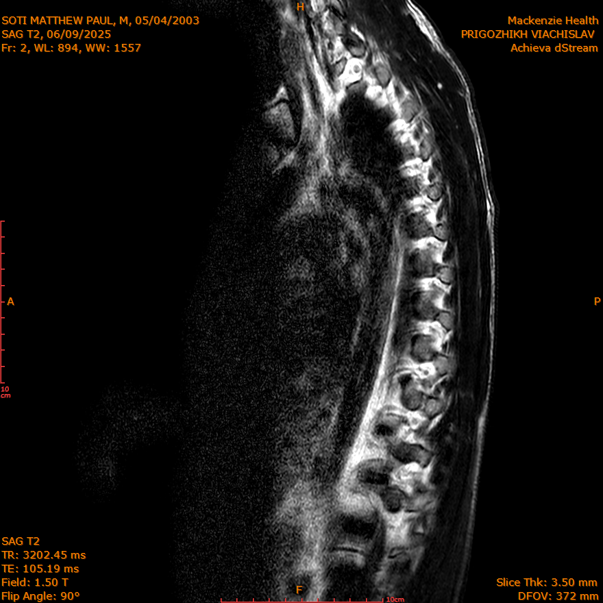 2025-06-09/SAG T2/0003-IM257.png