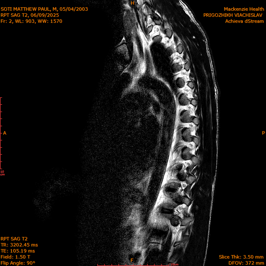 2025-06-09/SAG T2/0003-IM287.png