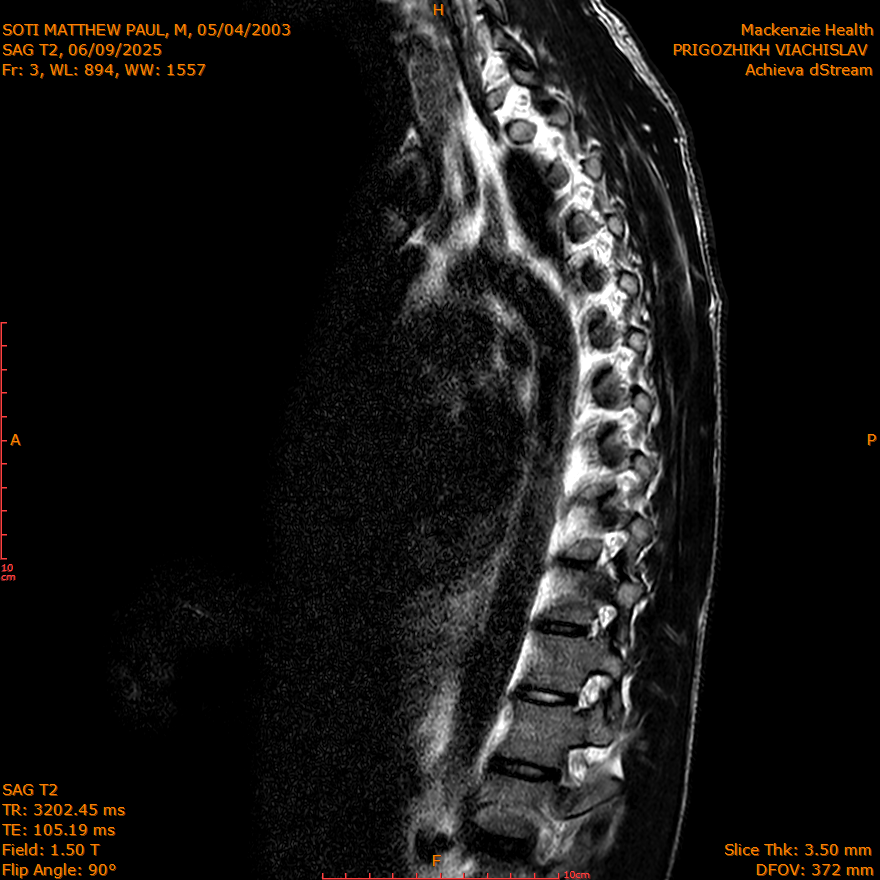 2025-06-09/SAG T2/0004-IM258.png