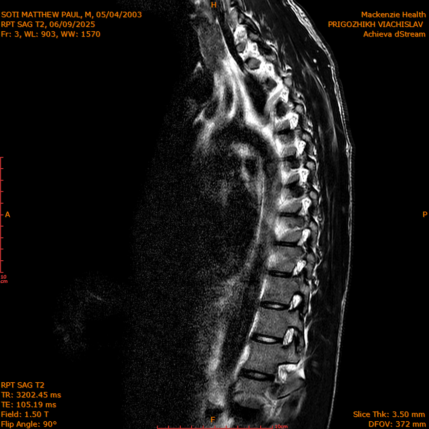 2025-06-09/SAG T2/0004-IM288.png