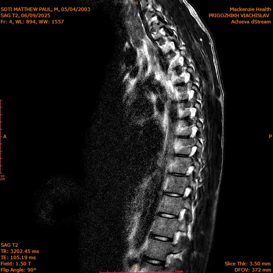 2025-06-09/SAG T2/0005-IM259.png