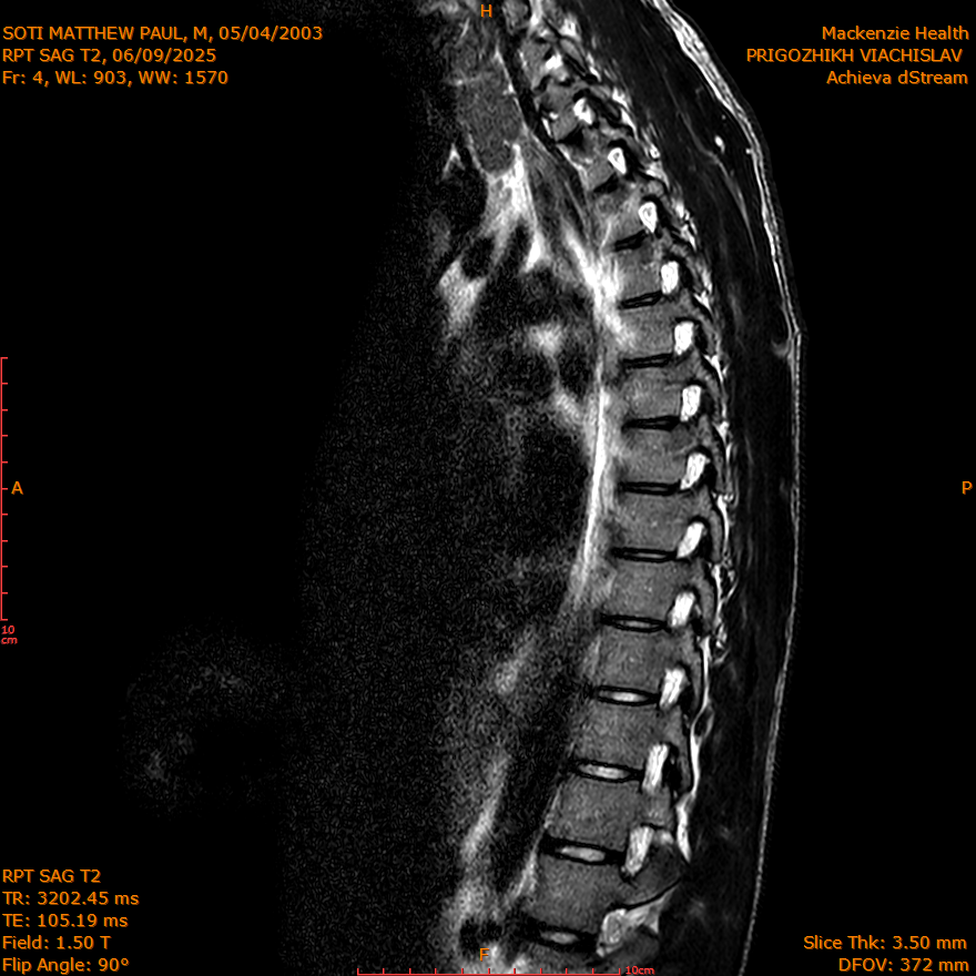 2025-06-09/SAG T2/0005-IM289.png